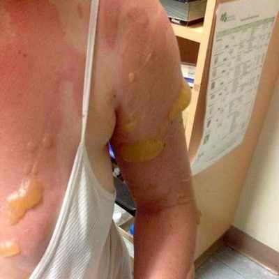 chncdhaHR0cHM6Ly9tYXJrZXRpdW0ucnUvd3AtY29udGVudC91cGxvYWRzLzIwMTYvMDcvb3Bhc25vc3Qtc2tvcm92YXJraV9jODFlNzI4ZDlkNGMyZjYzNmYwNjdmODljYzE0ODYyYy5qcGc=.prx.bd4c270d