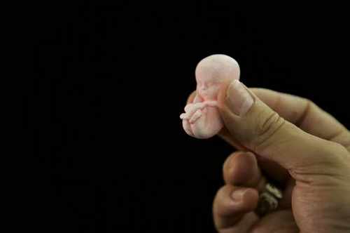 ab80aee574723721e3f4a5a78a6bd85c