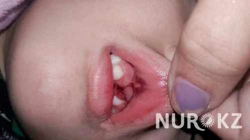 pogudx4ce5btfg1lv.69527807