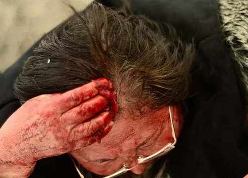 pogudxkmv6kqpk868.e5a2872a