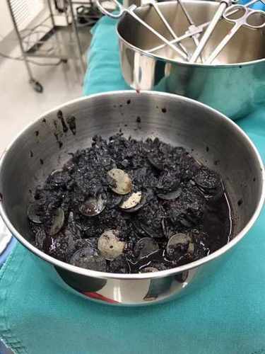 9a54acb5e91dd3d1d6d128d14bcb4220