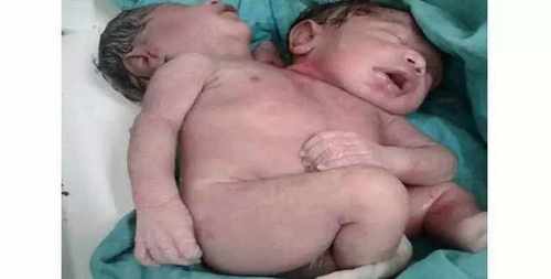 pogudx4s165f85gqu.4598b58e