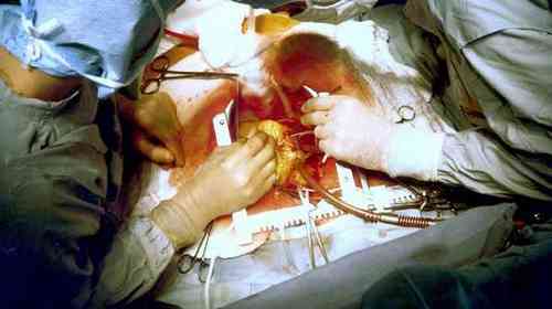 pogudx17hj9l2cvra8.c9f26a93